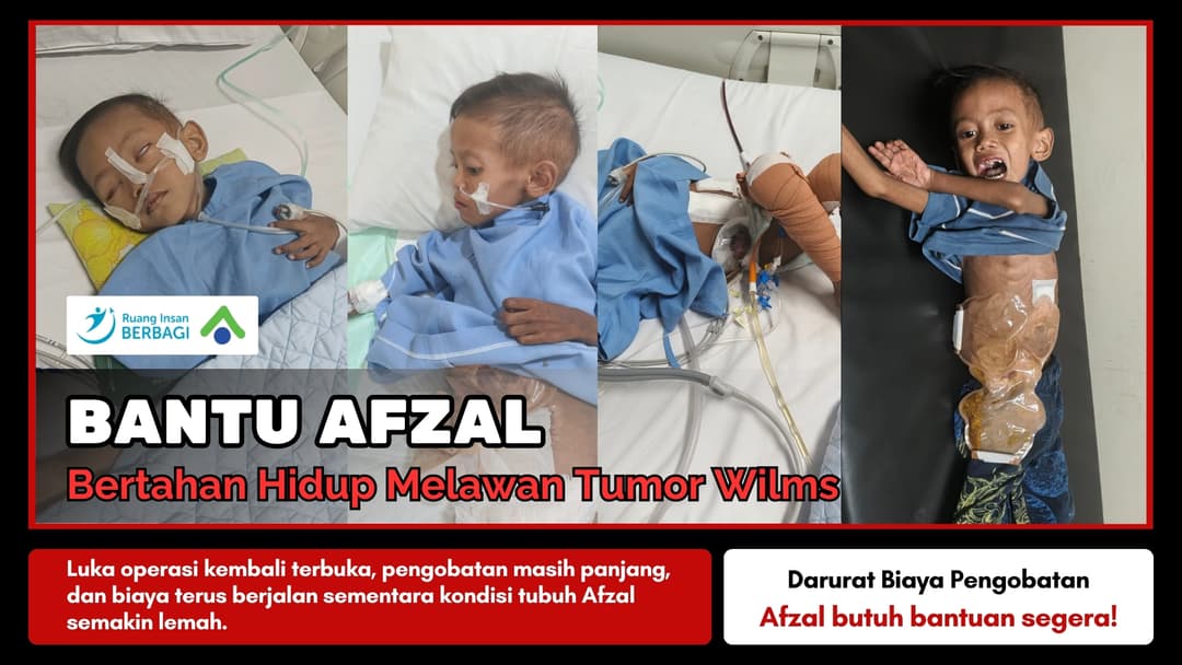 BANTU AFZAL BERTAHAN HIDUP MELAWAN TUMOR WILMS